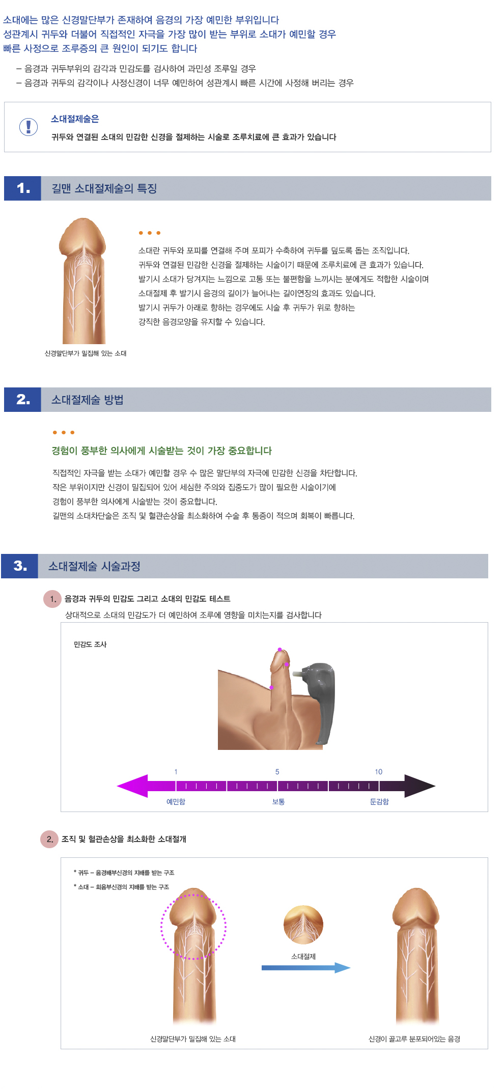 -소대절제술